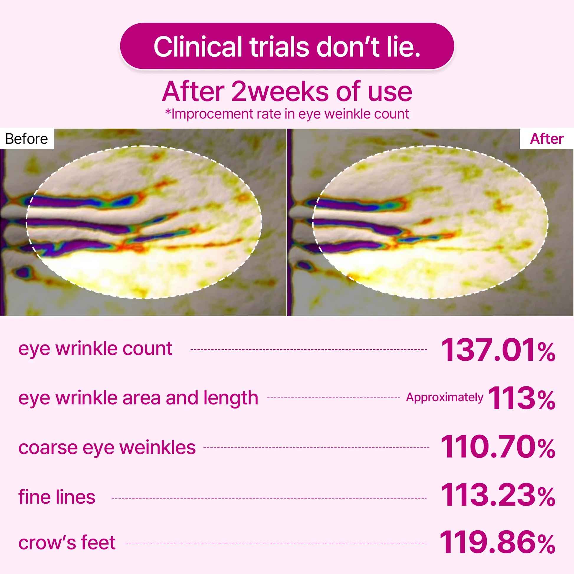 Cemenrete Calcium Eye Lift Duo