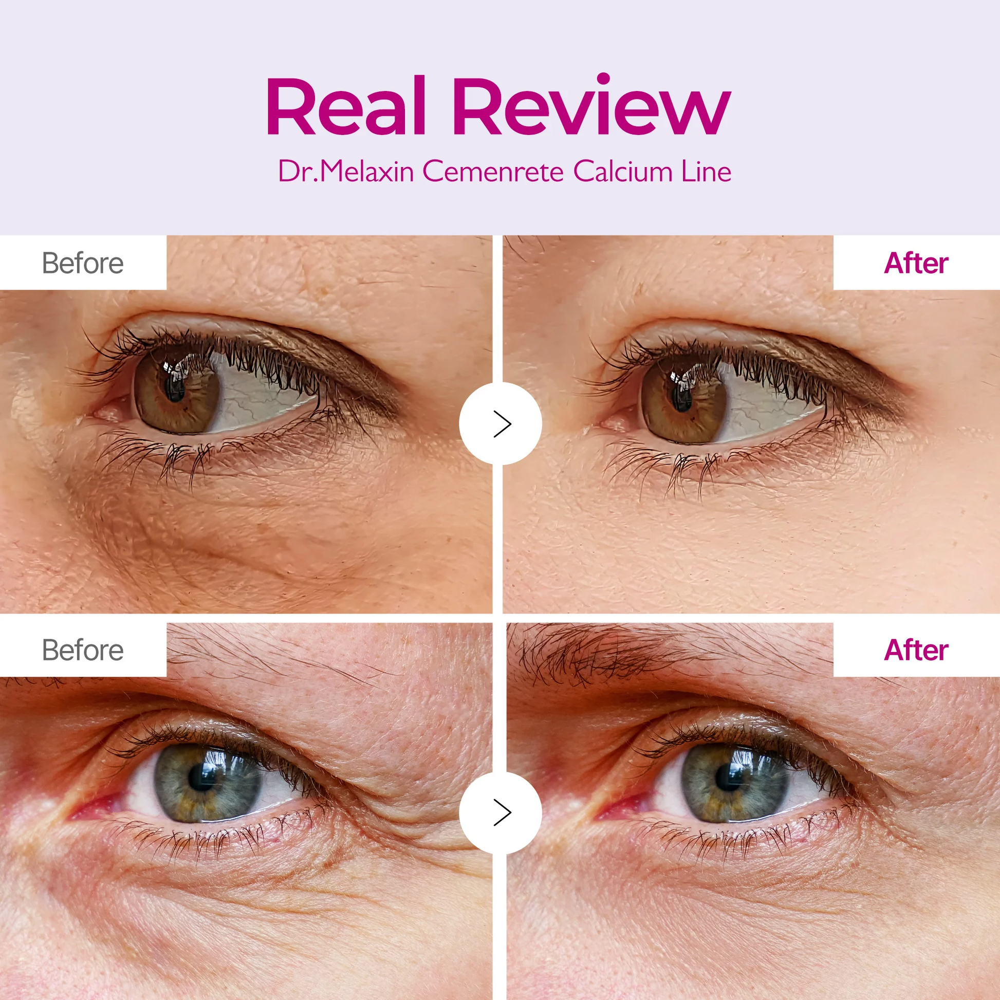 Cemenrete Calcium Eye Lift Duo